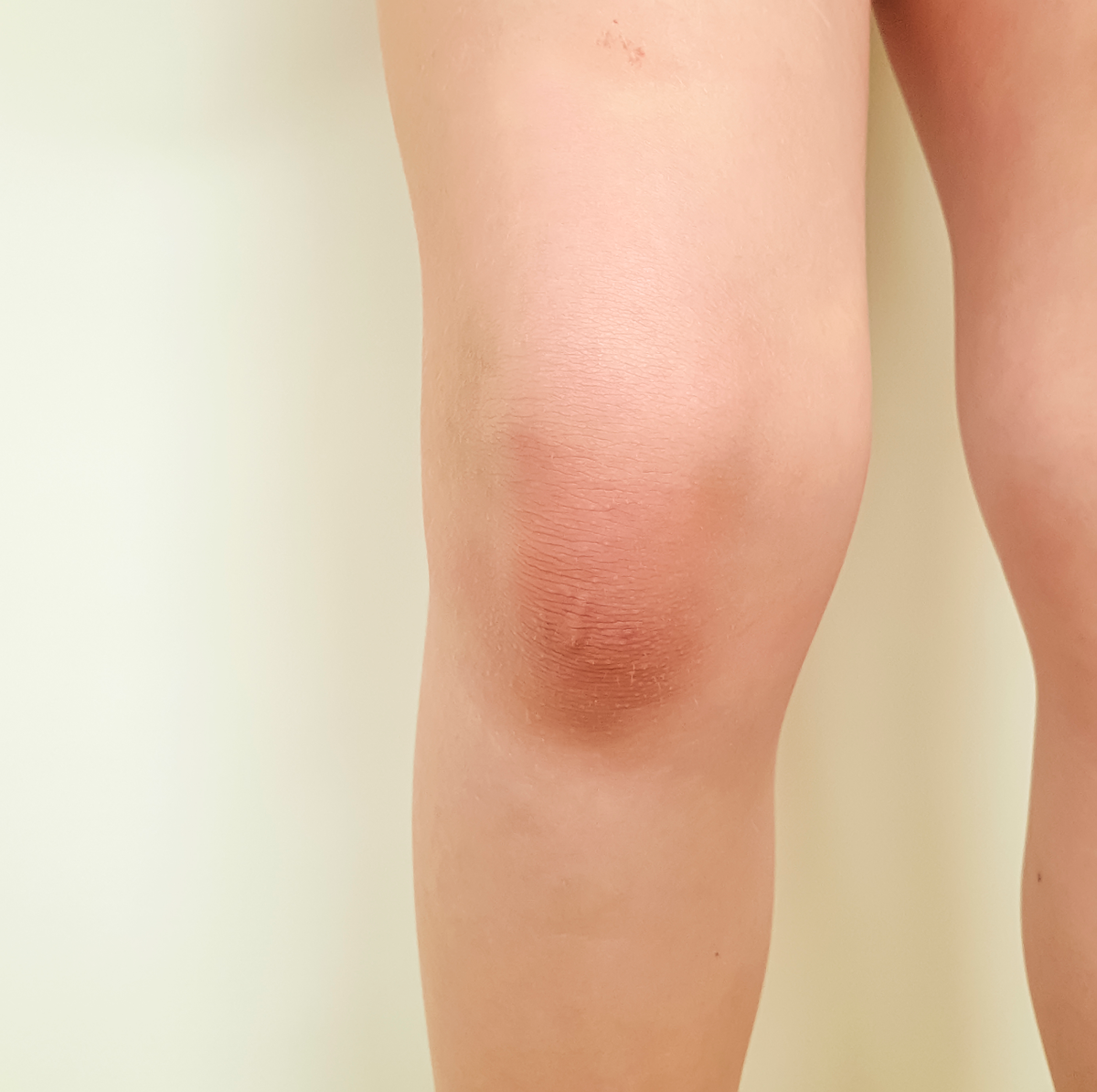 Knie